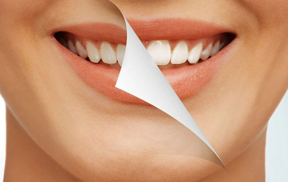 Contraindications for teeth whitening